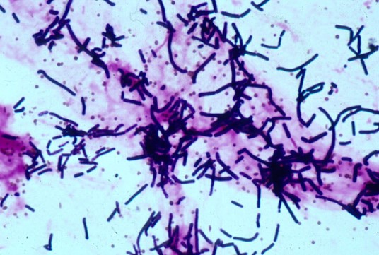 Zinmax dạng tiêm thường dùng điều trị nhiễm trùng do vi khuẩn chưa xác định