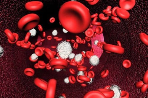  Thiếu máu là biểu hiện thường gặp nhất của bệnh bạch cầu