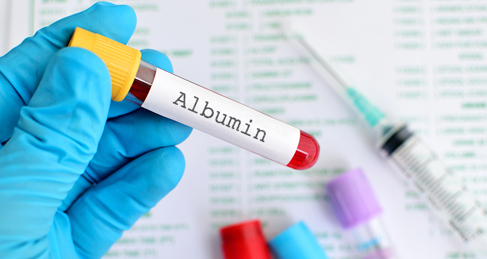 Albumin là một thành phần protein quan trọng nhất của huyết thanh, chiếm đến 58-74% lượng protein toàn phần