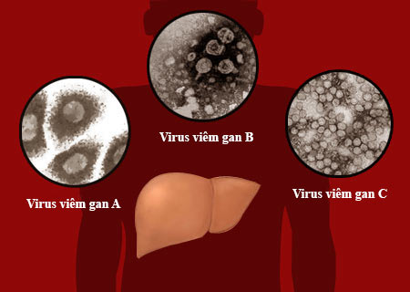 Có năm loại bệnh viêm gan