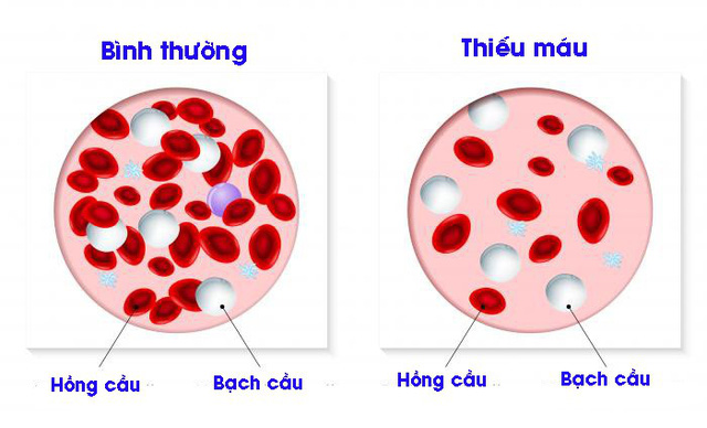 Tế bào hồng cầu 