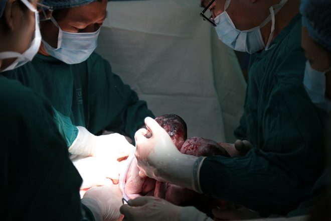 Các bác sĩ Bệnh viện Từ Dũ và Bệnh viện Nhi Đồng 1 phẫu thuật bắt con