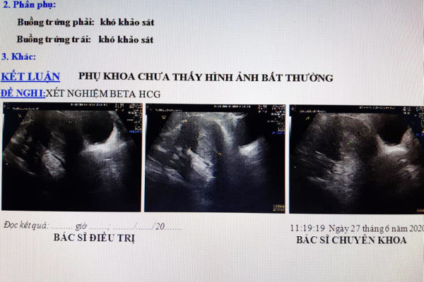 Vác bụng đi đẻ mà không có thai