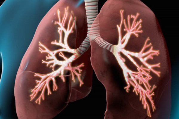 9 dấu hiệu giúp nhận biết sớm ung thư phổi