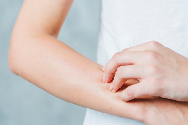 Bệnh viêm mao mạch dị ứng có thể chữa khỏi được không?