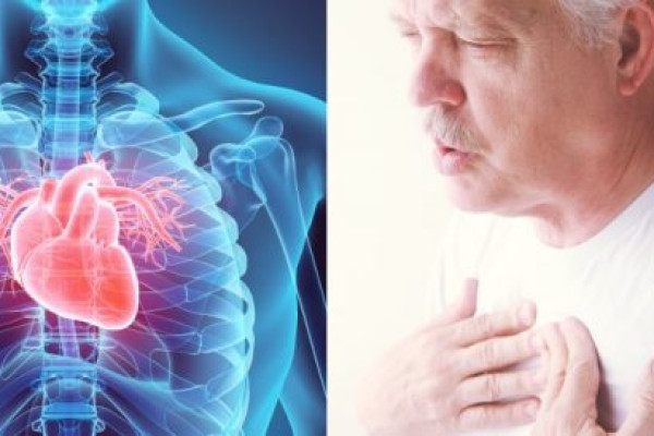 Biến chứng nguy hiểm của bệnh cơ tim phì đại là gì?