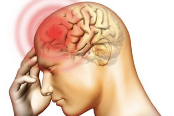 Các biến chứng của viêm màng não mủ là gì? Cách điều trị ra sao?