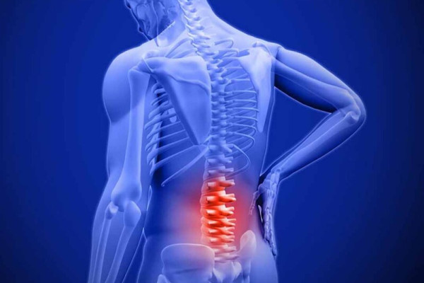 Các phương pháp điều trị viêm cột sống dính khớp hiệu quả nhất