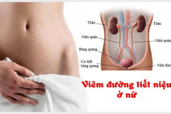 Các triệu chứng nhận biết sớm tình trạng viêm đường tiết niệu ở nữ giới