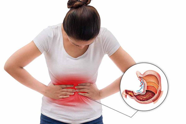 Cách xử lý đau dạ dày tại nhà nhanh chóng và hiệu quả nhất