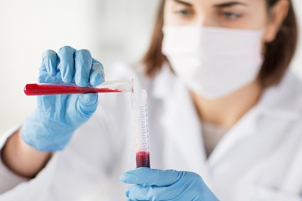 Tìm hiểu chỉ số xét nghiệm máu MCV là gì?