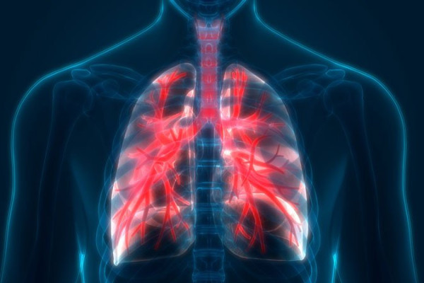 COVID-19 gây tổn thương phổi nặng hơn hút thuốc lá