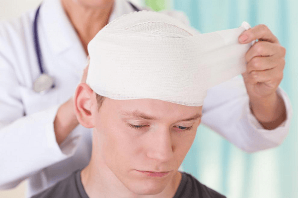 Dấu hiệu của chấn thương sọ não và cách điều trị