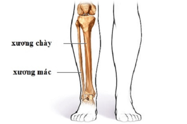 Gãy xương mác sẽ sử dụng phương pháp nào để điều trị hiệu quả bệnh?