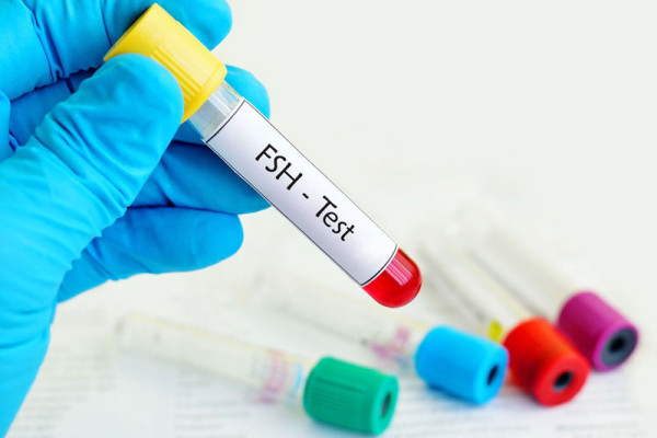 Hormone FSH là gì? Chỉ số như thế nào là bình thường?