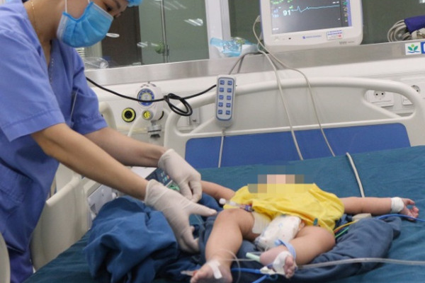Lấy nhầm cồn rửa mũi cho con, bé 8 tháng tuổi phải lọc máu liên tục