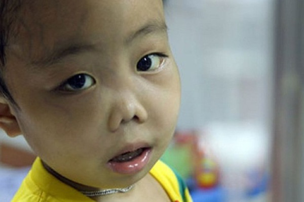 Nguyên nhân bệnh tan máu bẩm sinh beta thalassemia