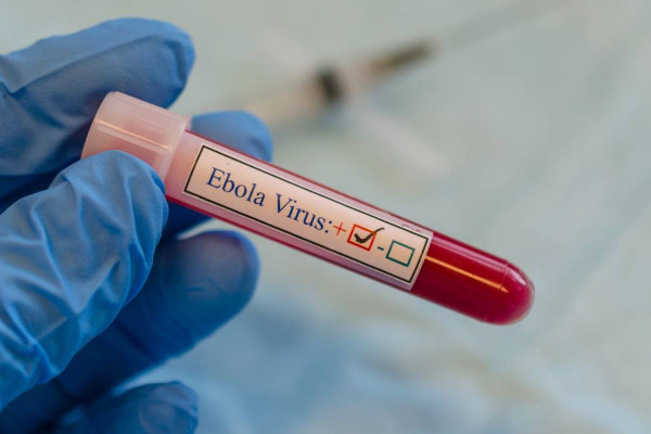 Nhận biết các triệu chứng và cách phòng tránh bệnh dịch Virus Ebola