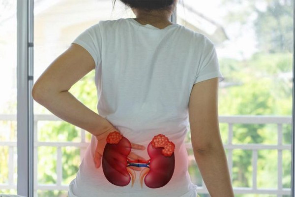 Những dấu hiệu nhận biết của bệnh áp xe thận là gì?