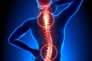 nhung-nguyen-nhan-nao-dan-den-bi-chan-thuong-cot-song