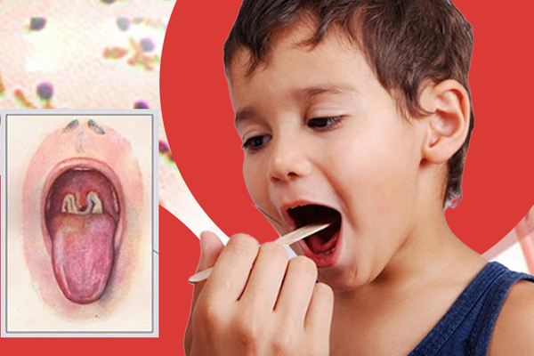 Những phương pháp nào dùng để điều trị bệnh bạch sản?