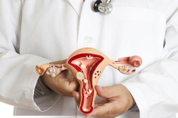 Polyp cổ tử cung có thể nhận biết qua những dấu hiệu nào?