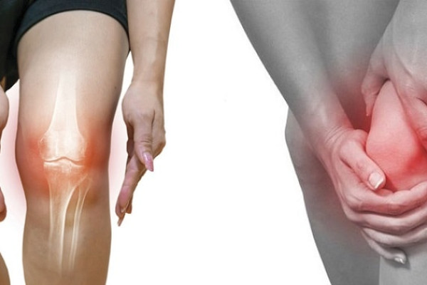 Thuốc Auranofin dùng trong điều trị bệnh gì? Cách sử dụng ra sao?