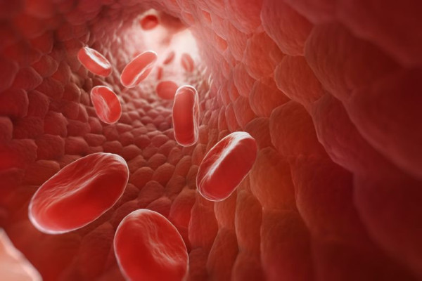 Tìm hiểu về bệnh đa hồng cầu nguyên phát