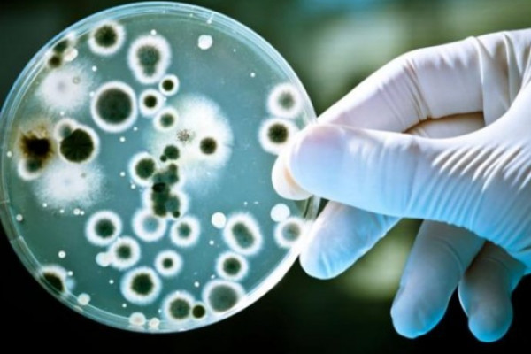 Tìm hiểu Xét nghiệm vi sinh là gì?