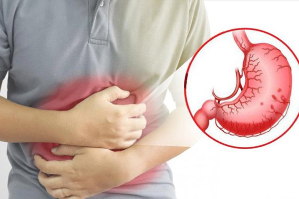 Triệu chứng điển hình của bệnh viêm loét dạ dày là gì?