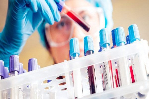 Xét nghiệm máu học ngành gì phù hợp?