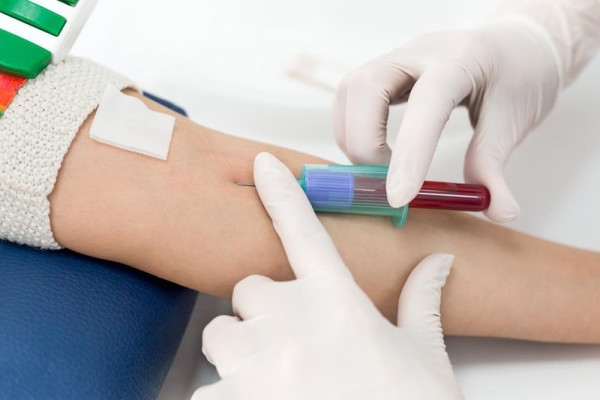Xét nghiệm máu WBC là gì?Tại sao cần thực hiện xét nghiệm WBC?