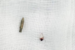 ban-de-but-bi-duoi-ghe-be-trai-12-tuoi-bi-dam-thau-vung-biu