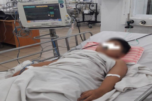 be-8-tuoi-moi-tim-mau-chuyen-mau-nau-do-ngo-doc-methemoglobin-nang