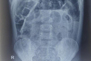 be-trai-8-tuoi-suyt-vo-ruot-vi-bi-tao-bon-nhung-cha-me-chu-quan