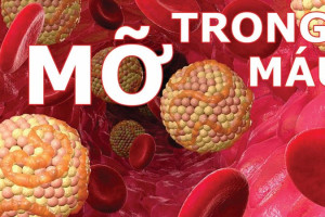 benh-mo-mau-co-nguy-hiem-khong-nguoi-mac-benh-mo-mau-nen-an-gi