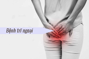 benh-tri-ngoai-la-gi-cach-dieu-tri-benh-tri-ngoai-hieu-qua