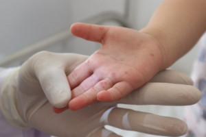 dak-lak-gan-290-ca-mac-1-ca-tu-vong-do-tay-chan-mieng