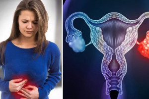 dau-hieu-dien-hinh-canh-bao-som-ung-thu-buong-trung