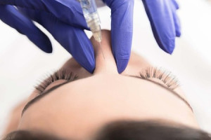 hoai-tu-mui-sau-tiem-filler-tham-my