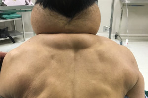 mot-nguoi-dan-ong-bien-thanh-nguoi-khong-lo-sau-nhieu-nam-nghien-ruou