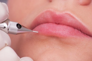 nhap-vien-dieu-tri-vi-moi-sung-vu-sau-khi-xam-moi-don-tet