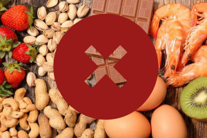 nhung-dieu-can-lam-khi-bi-di-ung-thuc-pham