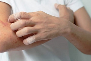 tim-hieu-ky-thuat-chan-doan-va-dieu-tri-benh-viem-da-co