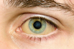 tim-hieu-nguyen-nhan-nao-dan-den-tinh-trang-vang-mat