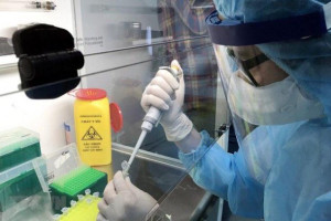 vi-sao-ca-nghi-nhiem-covid-19-nguoi-indonesia-duong-tinh-roi-lai-am-tinh