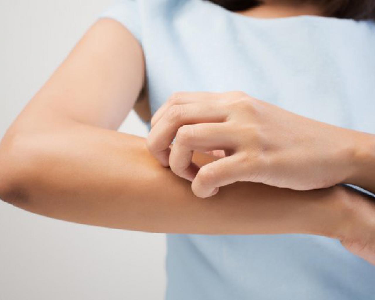 Cetirizin giúp giảm các triệu chứng dị ứng