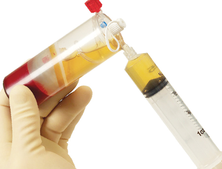 Sự kh&aacute;c biệt giữa huyết thanh v&agrave; huyết tương