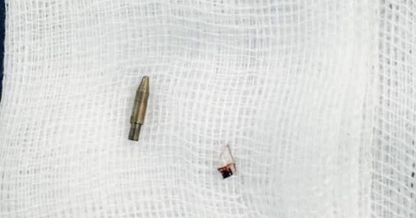 Bạn để bút bi dưới ghế, bé trai 12 tuổi bị đâm thấu vùng bìu