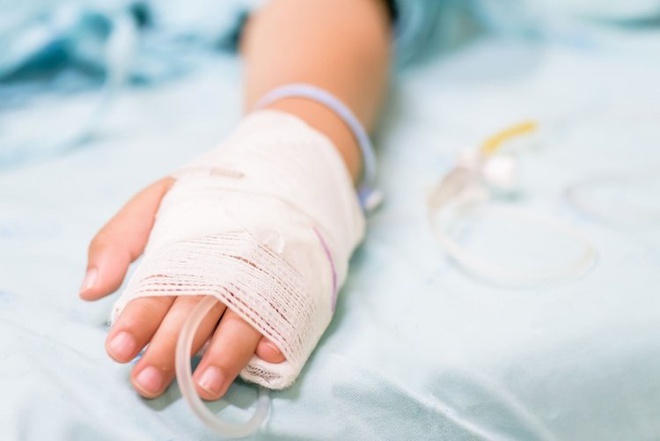 Bé 1 tuổi nhiễm trùng nặng do cha mẹ đắp thuốc lá trị bỏng